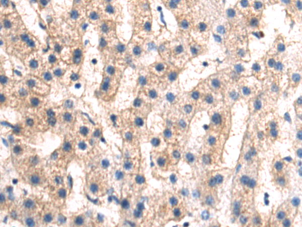 Rabbit Polyclonal Antibody to CACNA2D4