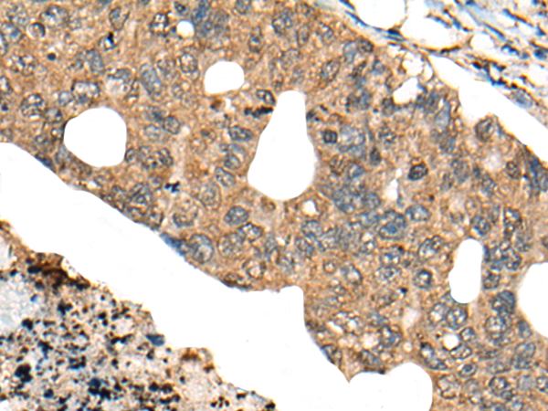 Rabbit Polyclonal Antibody to PPP3R1