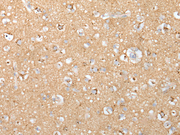 Rabbit Polyclonal Antibody to CLU/APO J