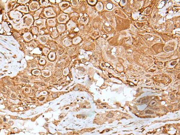 Rabbit Polyclonal Antibody to IL6ST