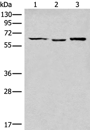 Rabbit Polyclonal Antibody to CALCOCO2