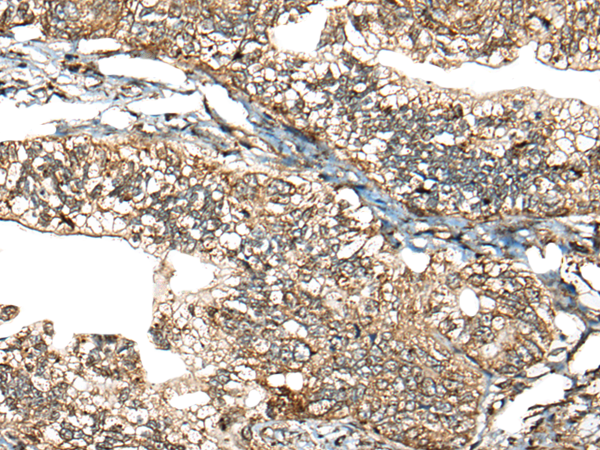 Rabbit Polyclonal Antibody to CALHM1