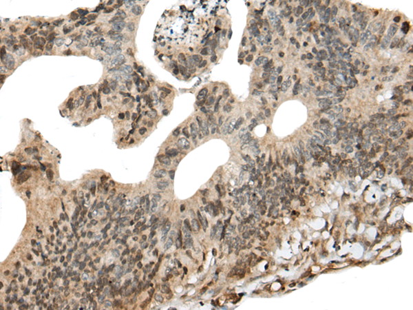 Rabbit Polyclonal Antibody to CALML5