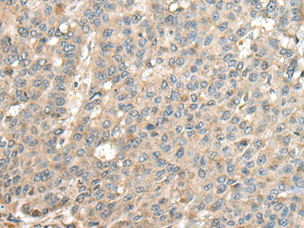 Rabbit Polyclonal Antibody to CASQ1