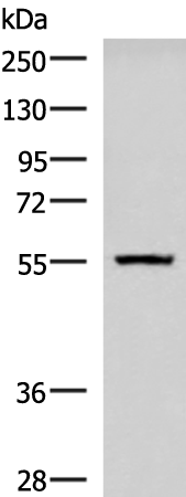 Rabbit Polyclonal Antibody to CAMKK1