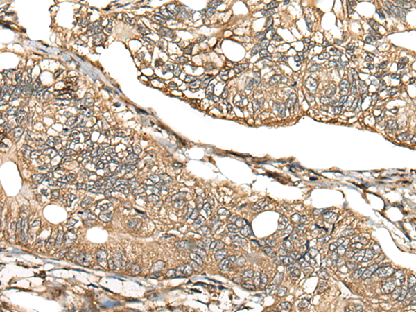 Rabbit Polyclonal Antibody to CA11