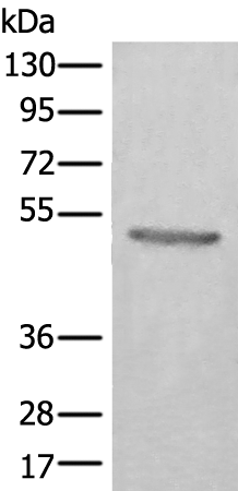 Rabbit Polyclonal Antibody to CPE