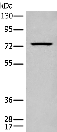 Rabbit Polyclonal Antibody to CARS1