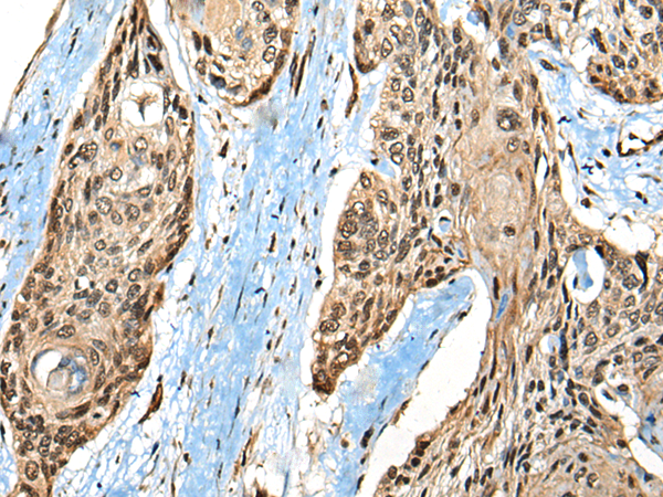 Rabbit Polyclonal Antibody to CASK