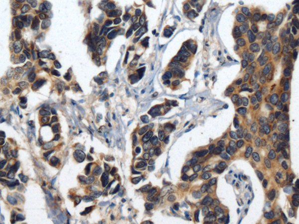 Rabbit Polyclonal Antibody to CAMP