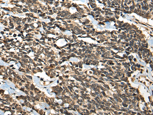 Rabbit Polyclonal Antibody to MICU1