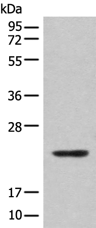 Rabbit Polyclonal Antibody to CBFB