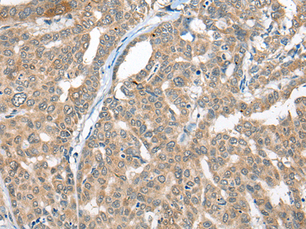 Rabbit Polyclonal Antibody to CBR3