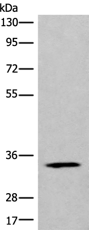 Rabbit Polyclonal Antibody to CCDC137