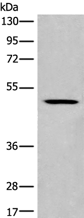 Rabbit Polyclonal Antibody to CCDC112