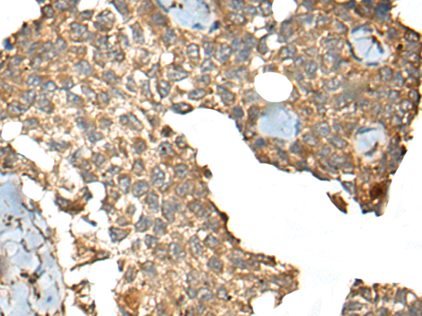 Rabbit Polyclonal Antibody to CCDC113