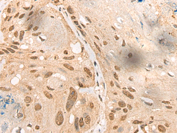 Rabbit Polyclonal Antibody to ABRAXAS1