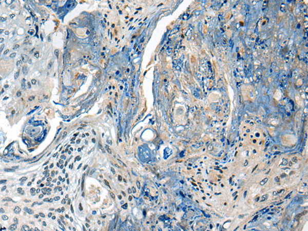 Rabbit Polyclonal Antibody to CCM2