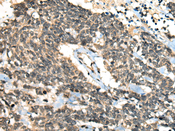 Rabbit Polyclonal Antibody to CCNB1IP1