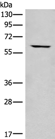 Rabbit Polyclonal Antibody to CCT6B