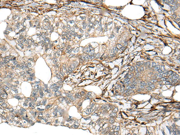 Rabbit Polyclonal Antibody to HMMR