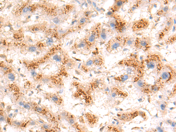 Rabbit Polyclonal Antibody to ST6GAL1