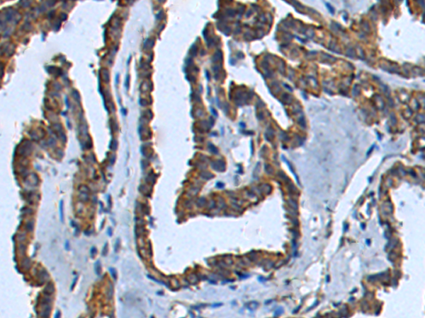 Rabbit Polyclonal Antibody to CD83