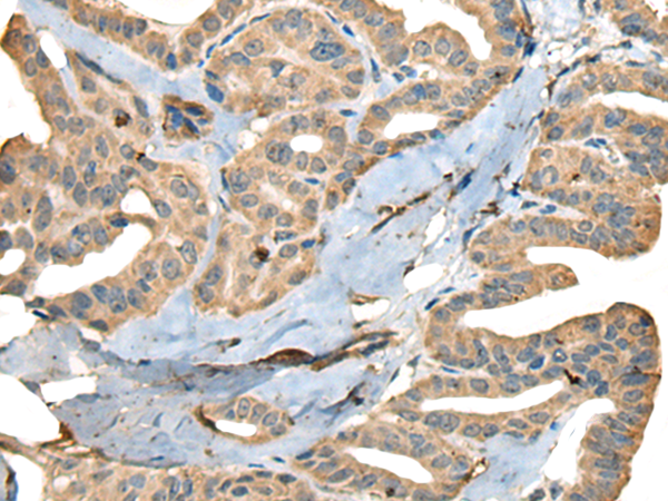Rabbit Polyclonal Antibody to CDADC1