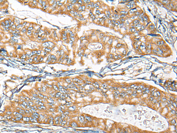 Rabbit Polyclonal Antibody to CDC42EP2