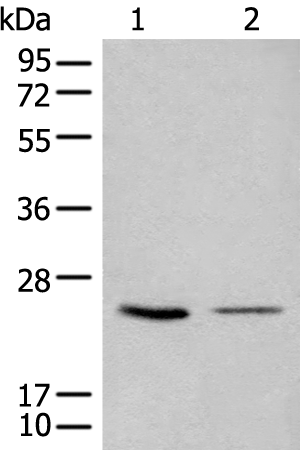 Rabbit Polyclonal Antibody to CDCA4