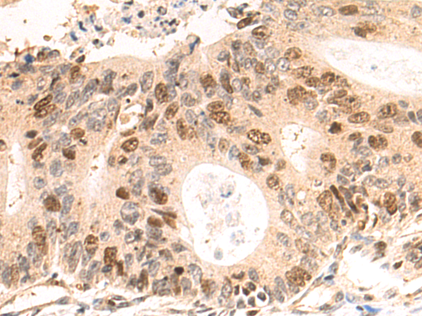 Rabbit Polyclonal Antibody to CDCA5