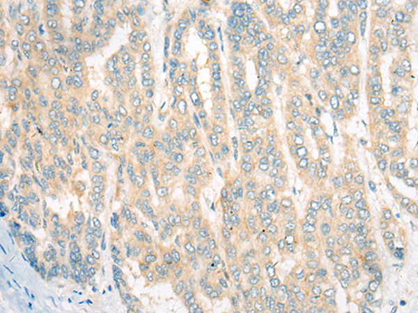 Rabbit Polyclonal Antibody to CDKAL1