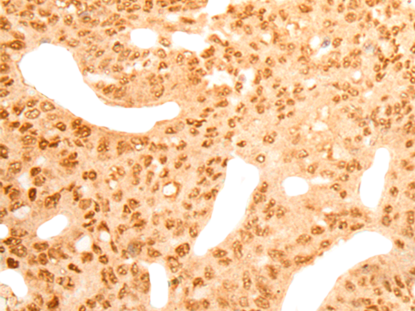 Rabbit Polyclonal Antibody to CDKN2AIPNL