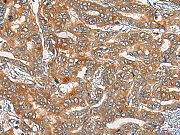 Rabbit Polyclonal Antibody to CDON