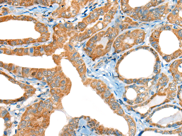 Rabbit Polyclonal Antibody to DTL