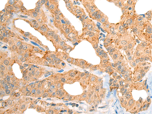 Rabbit Polyclonal Antibody to ADA2