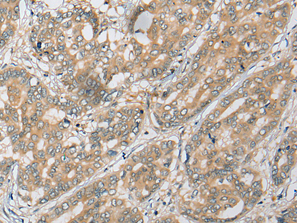 Rabbit Polyclonal Antibody to ADAP1