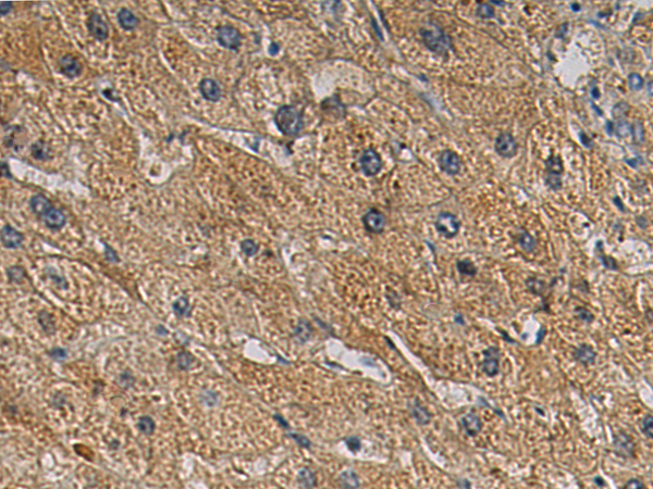 Rabbit Polyclonal Antibody to ADAP2