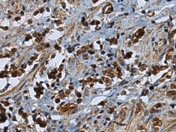 Rabbit Polyclonal Antibody to CETN2