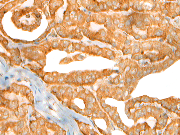 Rabbit Polyclonal Antibody to CEP72