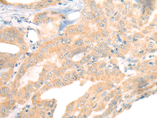 Rabbit Polyclonal Antibody to CEP290