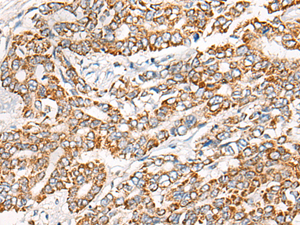 Rabbit Polyclonal Antibody to CER1