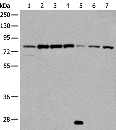 Rabbit Polyclonal Antibody to GARS1