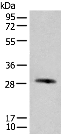 Rabbit Polyclonal Antibody to CFHR2