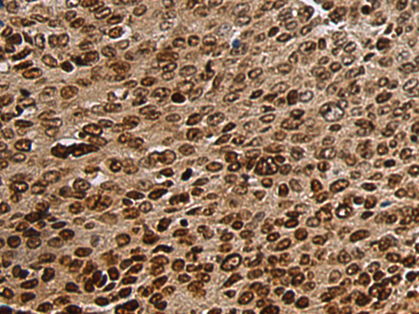 Rabbit Polyclonal Antibody to CXXC1
