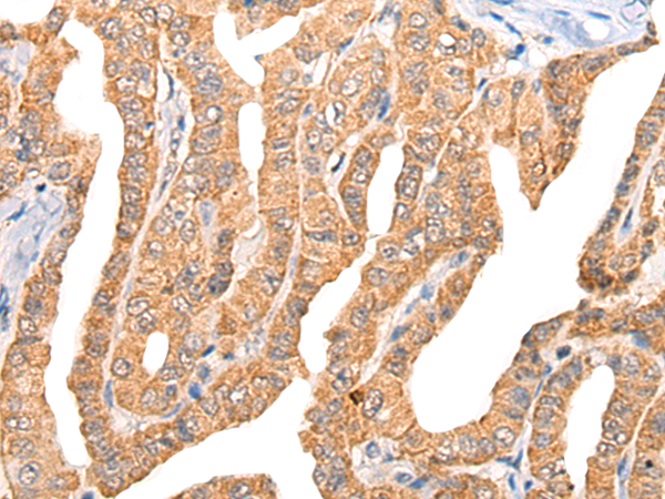 Rabbit Polyclonal Antibody to CGREF1