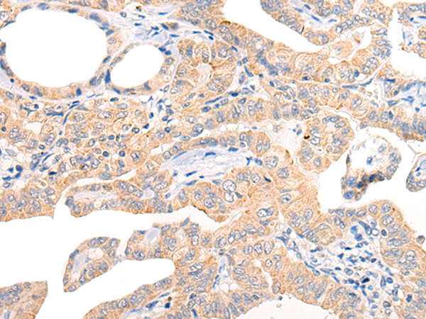 Rabbit Polyclonal Antibody to CHCHD5