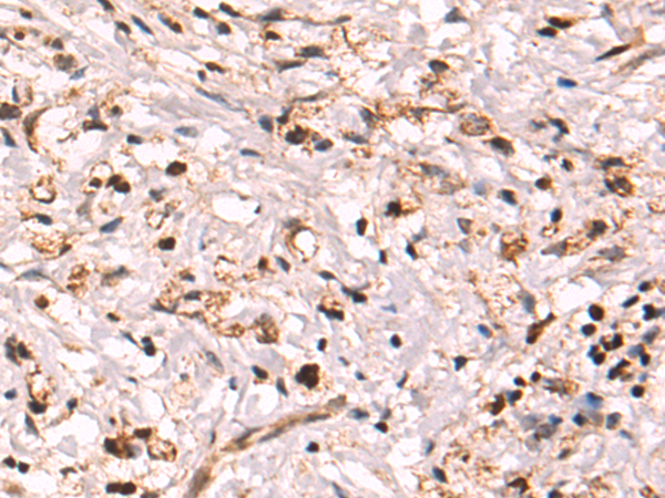 Rabbit Polyclonal Antibody to CHD2