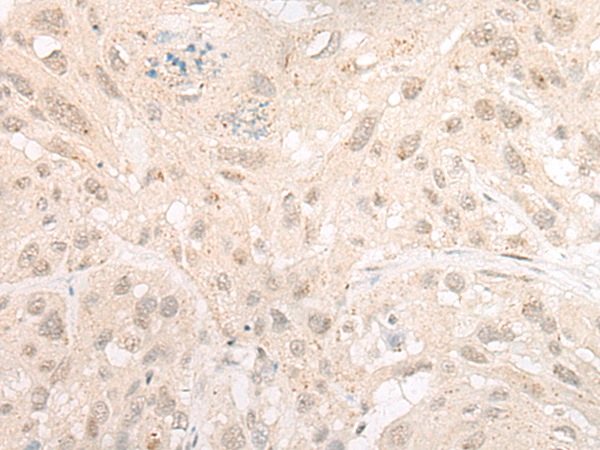Rabbit Polyclonal Antibody to CHERP
