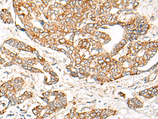 Rabbit Polyclonal Antibody to CHI3L2